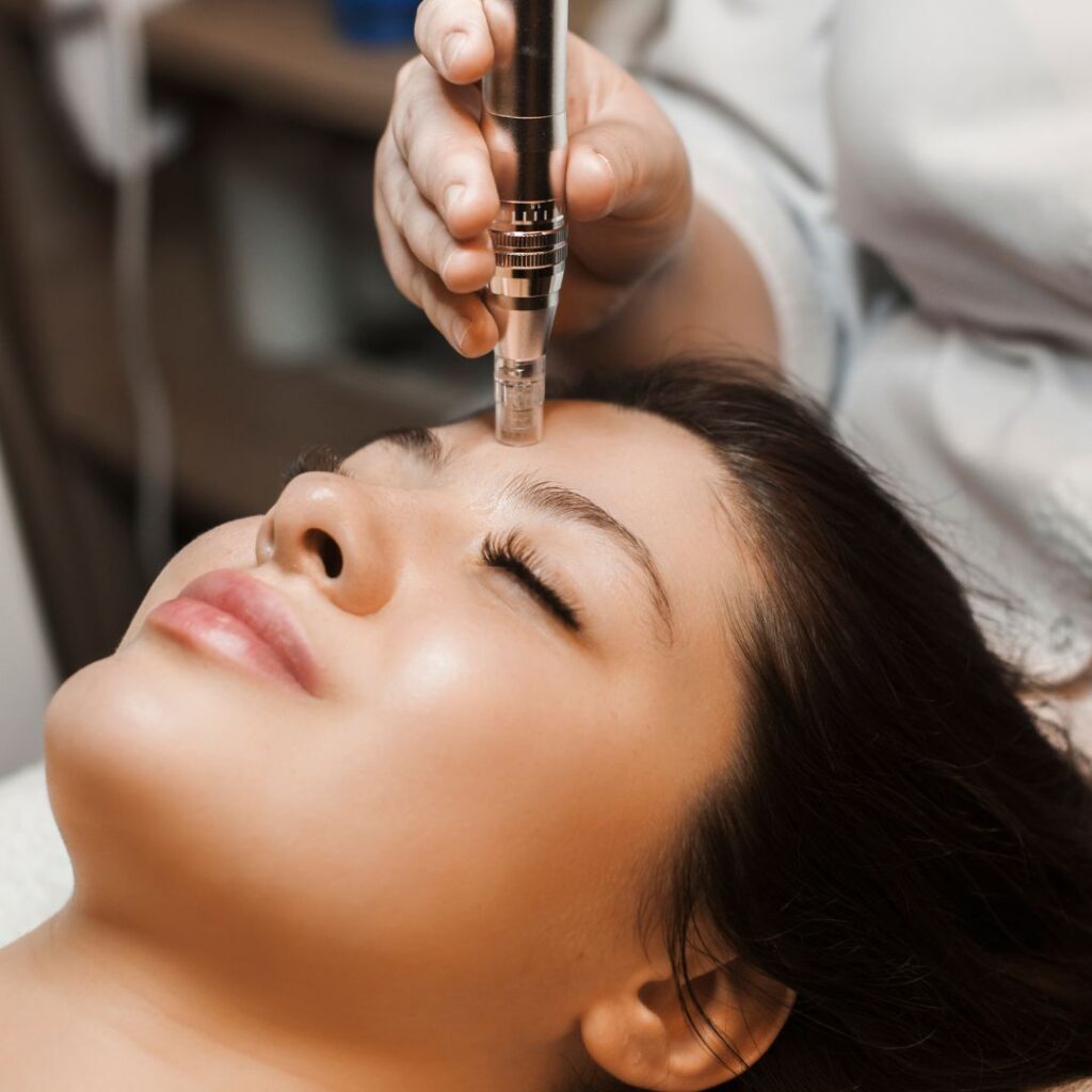 Microneedling benefits for skin